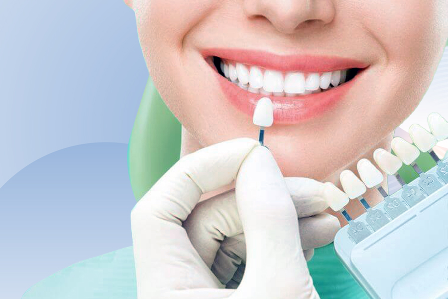 Porcelain Veneers